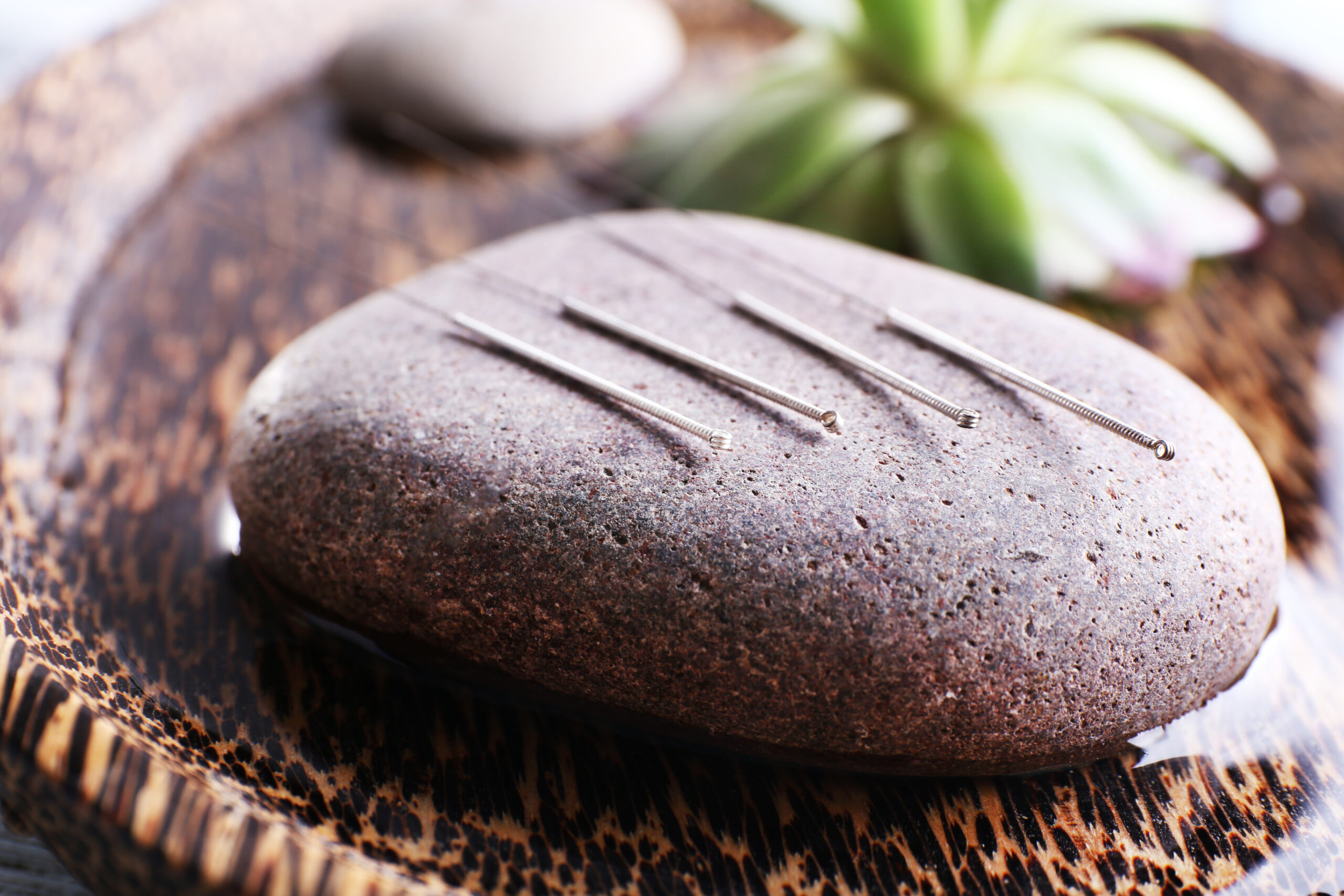 Acupuncture needles with spa stone on tray, closeup photo.